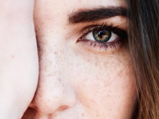 What's Causing Your Dark Under-Eye Circles (and What Experts Swear Will Help)