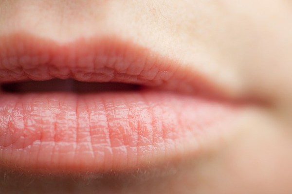 6 Tips on How to Get Rid of Chapped Lips
