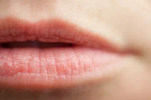 6 Tips on how to get rid of chapped lips