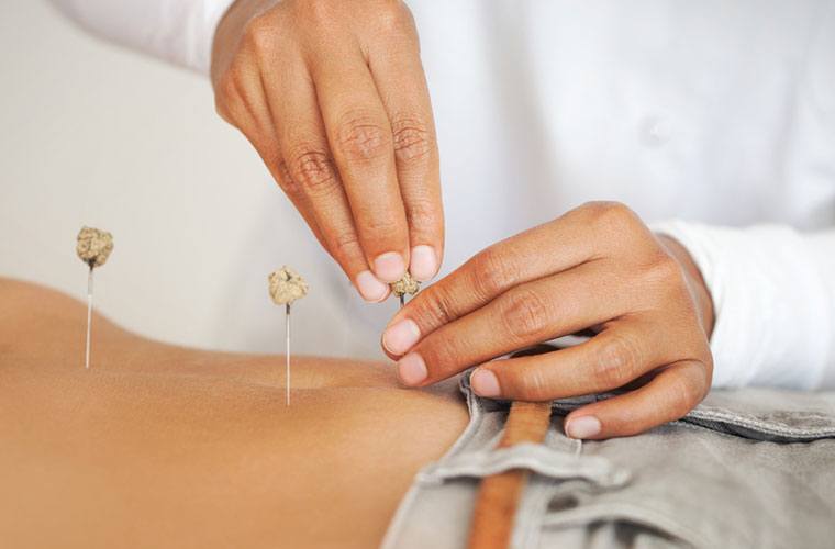 acupuncture may improve the outcome of IVF