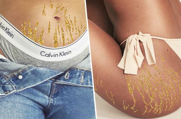 This Instagrammer Reimagines Stretch Marks Into Glittery Works of Self-Love Art