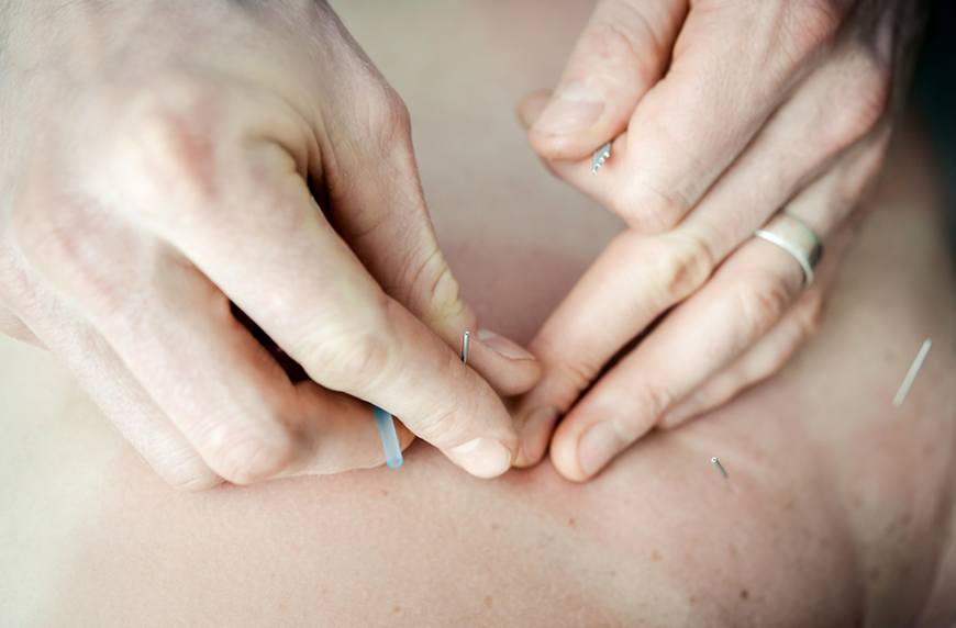 acupuncture to boost libido