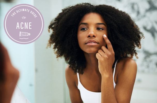 We Asked Over 700 People About Their Acne—Here's What They Had to Say