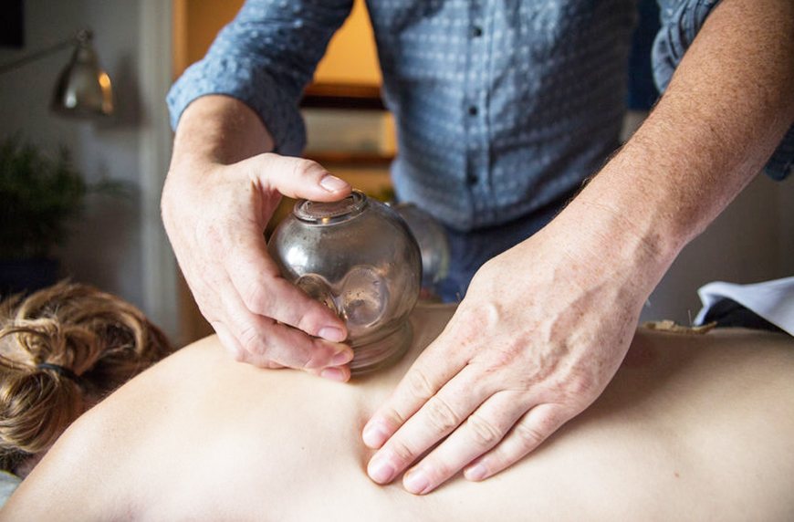 Where to find cupping therapy in New York City