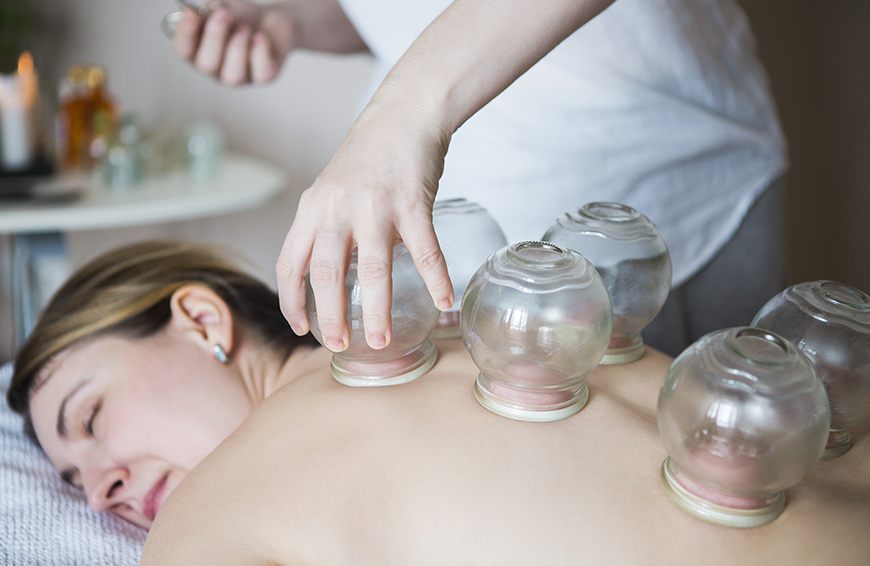 cupping therapy nyc