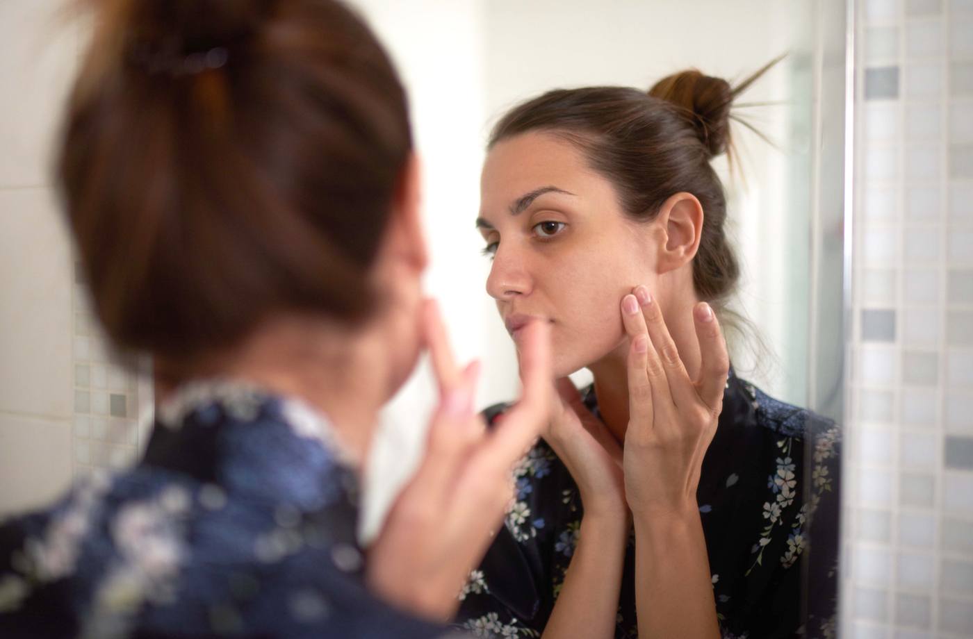 how to treat cystic acne