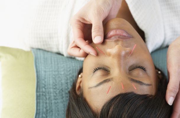 Curious About Acupuncture? Here's What You Should Know Before Trying It