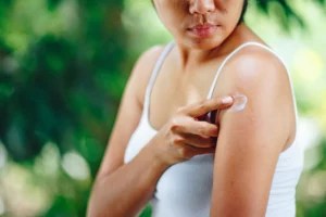 6 Derm-Approved Home Remedies for the Itchiest of Itchy Bug Bites