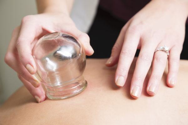 What Is Cupping Therapy, Anyway? One Editor Bared Her Back to Find Out