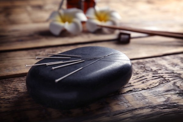 Asked and Answered: Does Getting Acupuncture Hurt—Even a Little Bit?
