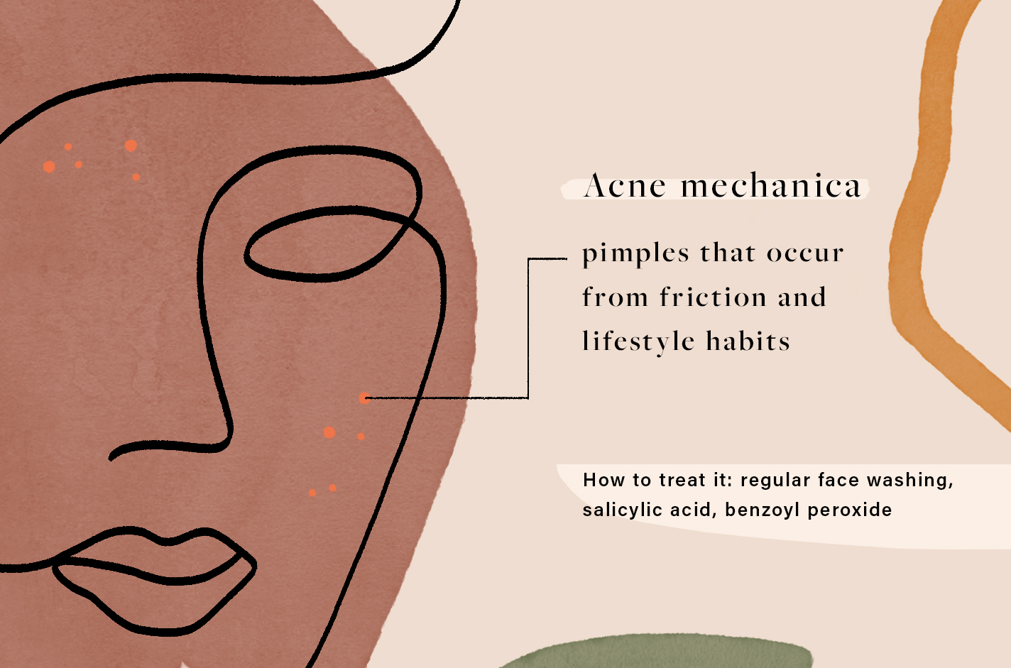 types of acne