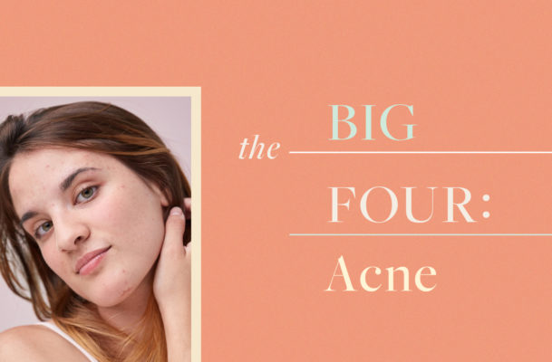 These 4 Ingredients Are the Only Ones You Need to Stop Acne in Its Tracks