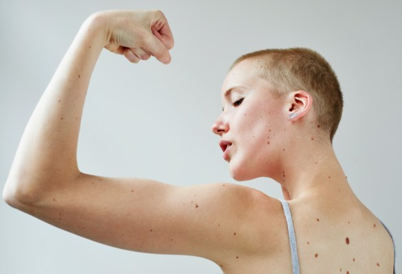 Muscle Mass Is Hard to Lose—so Don't Sweat It, Okay?