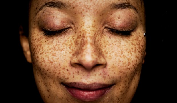 'I'm a Dermatologist, and This Easy Trick Will Tell You Exactly What Your Skin Type...