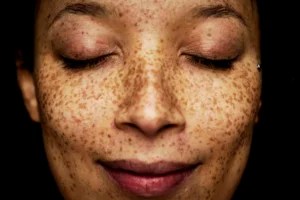 'I'm a Dermatologist, and This Easy Trick Will Tell You Exactly What Your Skin Type Is'