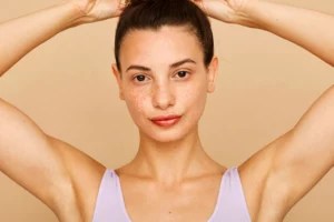 A Dermatologist Wants You To Know That Those Painful 'Armpit Pimples' May Not Actually Be Pimples at All