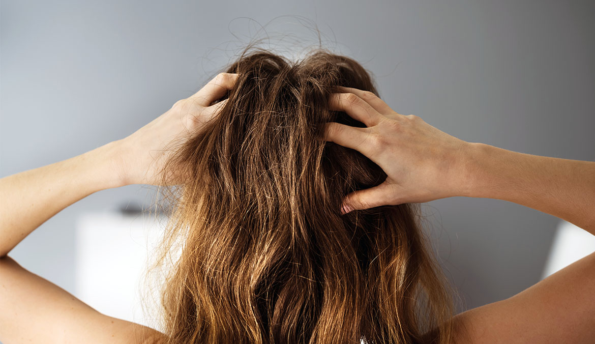 A woman rubbing her scalp.
