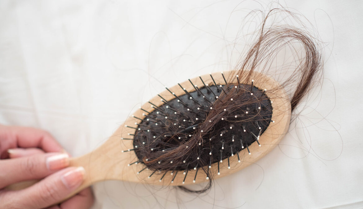 Up-close photo of a hairbrush with a clump of brunette hair stuch in the bristles, signifying hair loss.