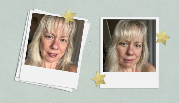 This 'Filler in a Bottle' Reduced the Wrinkles on My Mature Skin Within 10 Days
