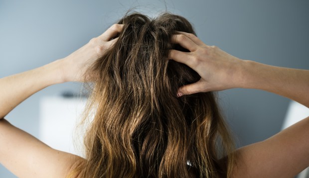 The 9 Best Home Remedies When Your Itchy Scalp Is Truly Driving You Bananas